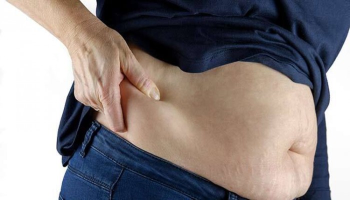 স্থূলতা বাড়াচ্ছে কঠিন রোগের ঝুঁকি, প্রতিরোধে করণীয়